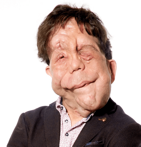 Adam Pearson