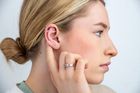 AcuPips Ear Seed Kit for Stress & Anxiety
