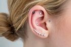 AcuPips Ear Seed Kit for Migraines & Head Pain