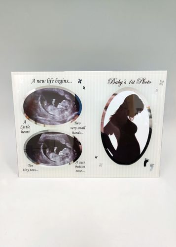 Baby Scan frame