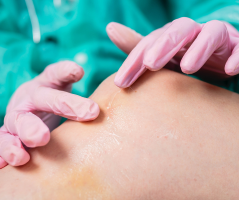 Predicting wound healing outcomes: a comparative accuracy analysis of AI-driven indices and percent area reduction