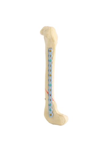 Latest Orthopedic Products