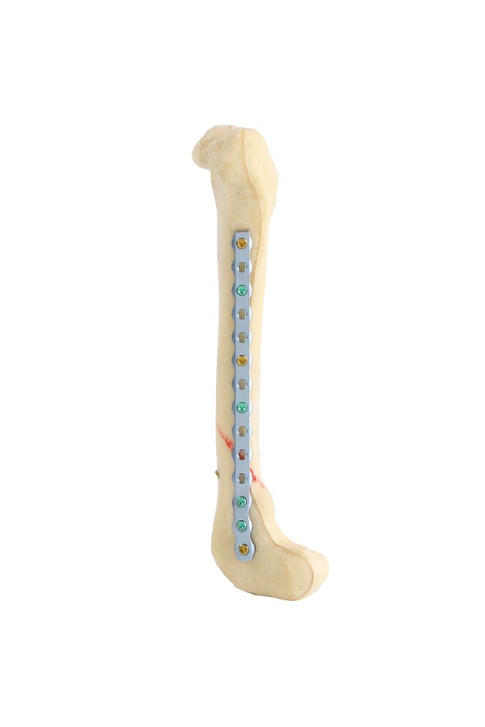 Latest Orthopedic Products