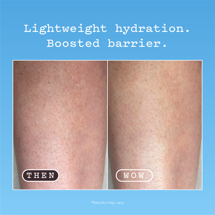 Hyaluronic Acid Body Serum