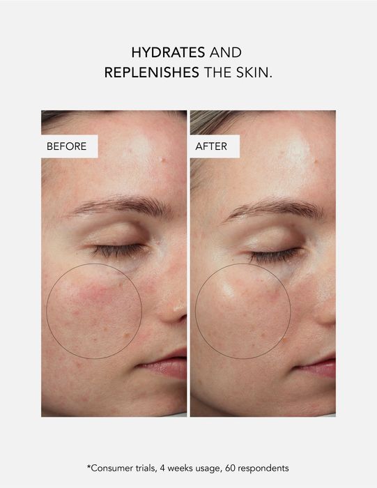 Dr Somji Skincare, Exosome Barrier Repair Serum