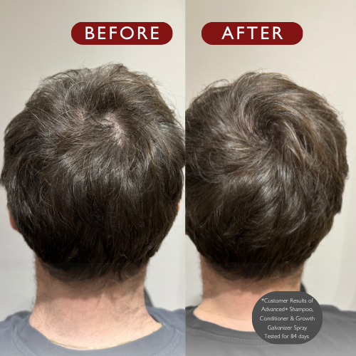 Advanced+ Hair Loss Conditioner 280ml