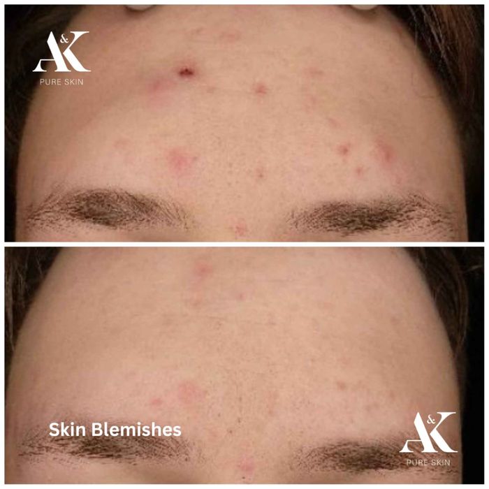 BRIGHTENING EXFOLIATING CLEANSER