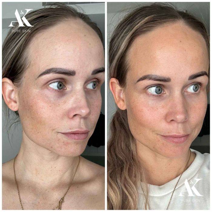 HYDRATING FACE TAN SERUM