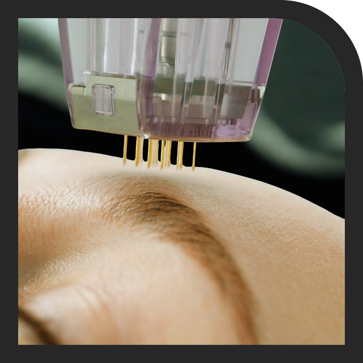 Skin boosters at clinics and at home at AesthetiX Live 2026 London Excel 17-18 October 2026 AesthetiX Live London Excel 10-11 April 2027 