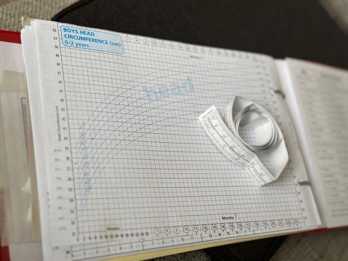 Measurement of the circumference of a 14 months old baby's head