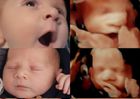 Pregnancy scans