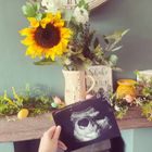 Pregnancy scans