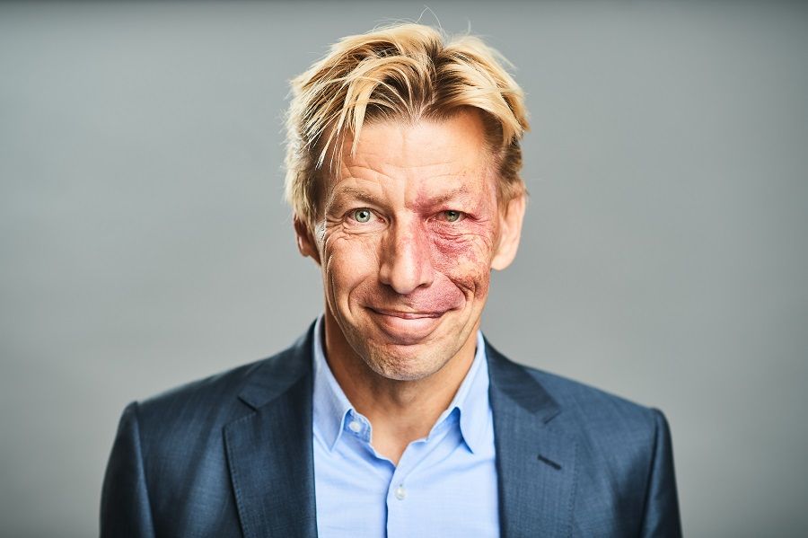 Chris Peeters