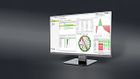 PSIngo: Transparency & automation platform for the distribution grid
