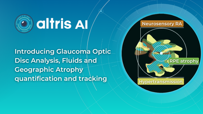 Altris AI Introduces 3 New AI-powered Features