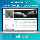 AI for OCT: Glaucoma Advanced Optic Disc Analysis