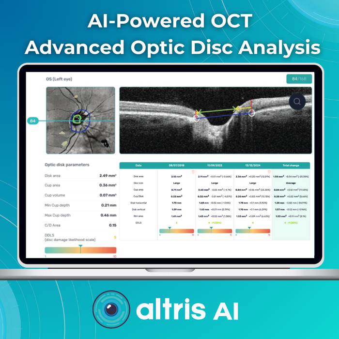 AI for OCT: Glaucoma Advanced Optic Disc Analysis