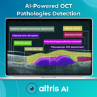 AI for OCT: Pathologies Detection