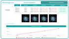 AI for OCT: Fluids Quantification