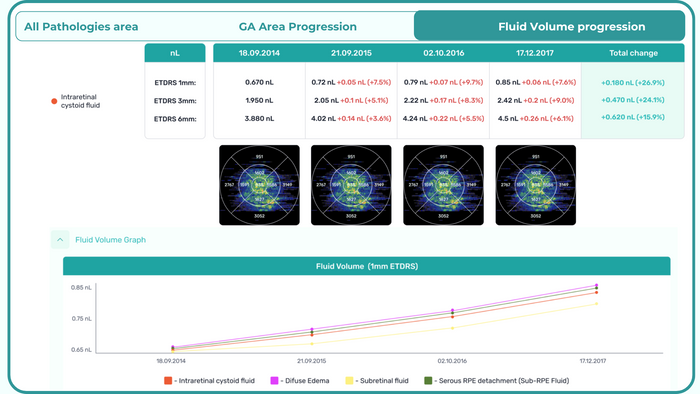 AI for OCT: Fluids Quantification