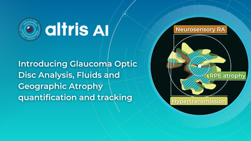 Altris AI Introduces 3 New AI-powered Features