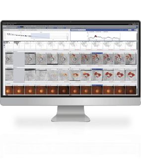 ZEISS Glaucoma Workplace