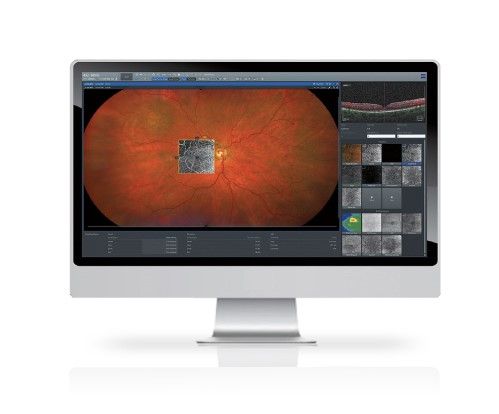 ZEISS Retina Workplace
