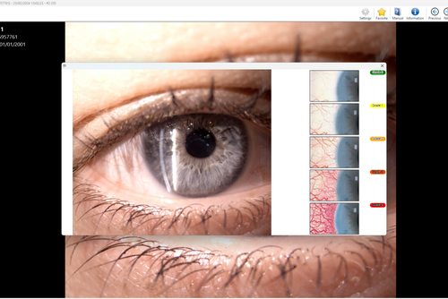 CSO SL99K Elite Digital Slit Lamp