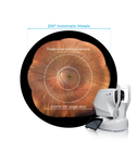 iCare EIDON - Ultra-Widefield Confocal System