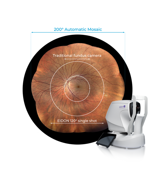 iCare EIDON - Ultra-Widefield Confocal System