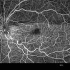 TowardPi Yalkaid - 100kHz full-range SS-OCT/A