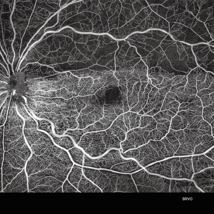 TowardPi Yalkaid - 100kHz full-range SS-OCT/A