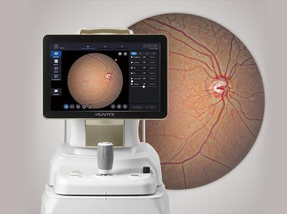 Huvitz OCTavius - 5-in-1 comprehensive system