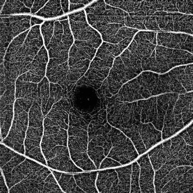 Huvitz OCTavius - 5-in-1 comprehensive system