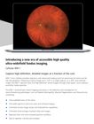 Discover the WRI-1 Cellview Ultra-Widefield Retinal Imaging System from Essilor Instruments