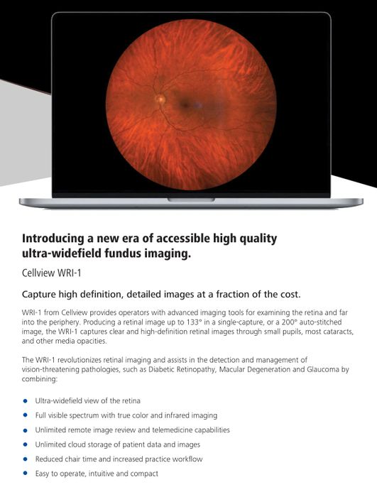 Discover the WRI-1 Cellview Ultra-Widefield Retinal Imaging System from Essilor Instruments