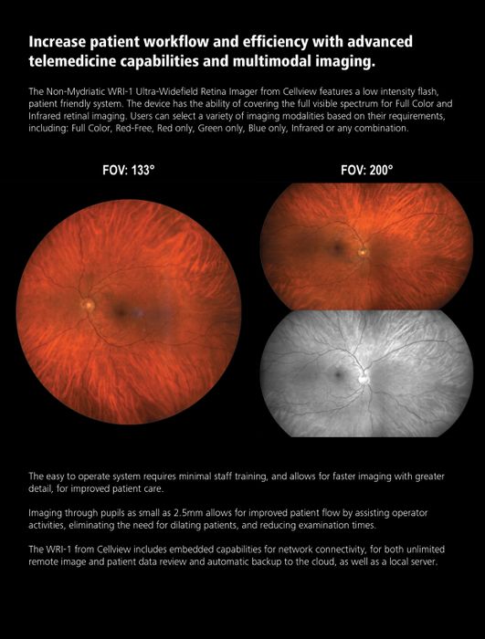 Discover the WRI-1 Cellview Ultra-Widefield Retinal Imaging System from Essilor Instruments