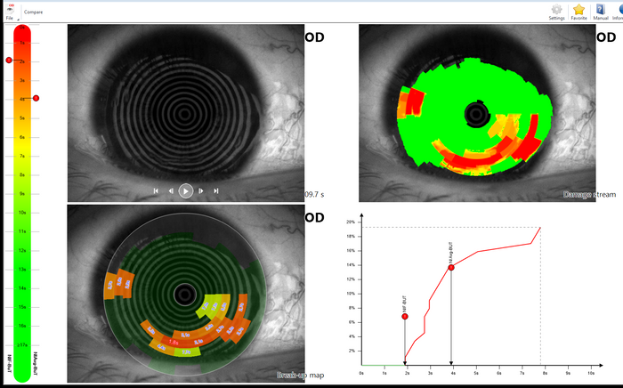 CSO Antares+ Topographer