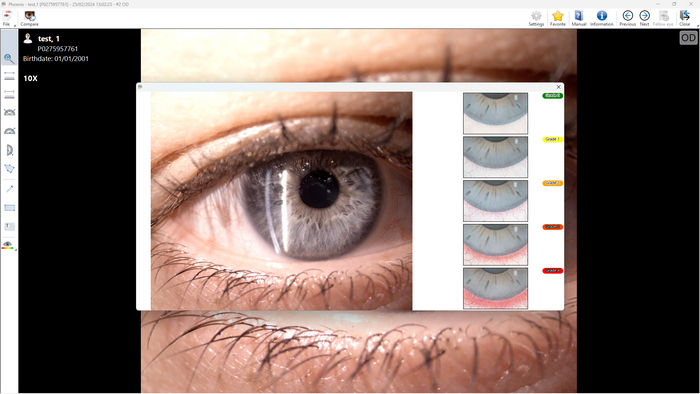 CSO SL99K Elite Digital Slit Lamp