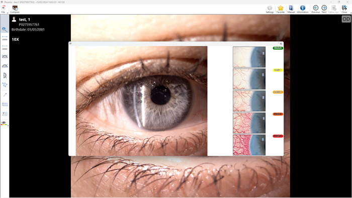 CSO SL99K Elite Digital Slit Lamp