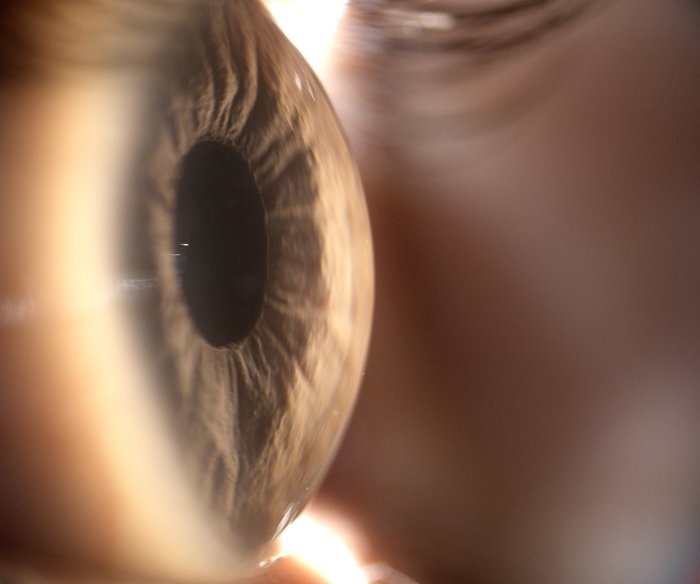 CSO SL9900 Digital LED Slit Lamp