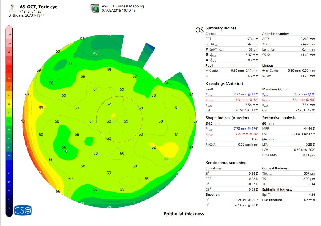 CSO MS-39 Anterior Segment OCT
