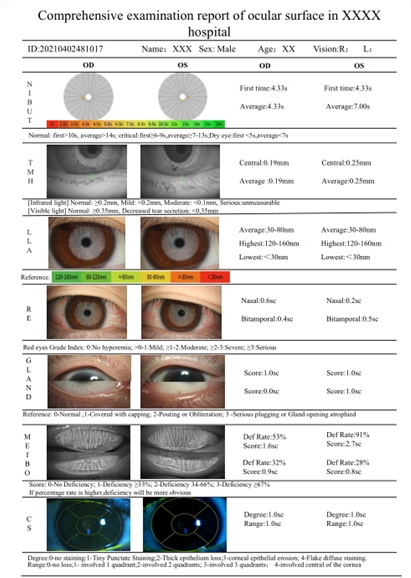 SK-MED LS-5C LED Digital Slit Lamp with Dry Eye Analyser