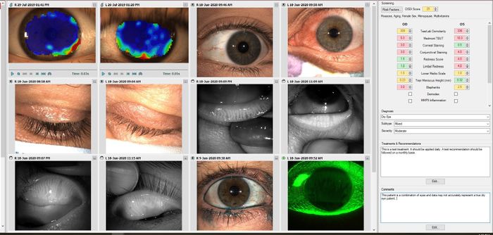 Medmont Meridia Vantage