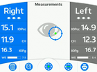 ORA G3 OCULAR RESPONSE ANALYSER