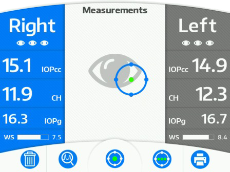 ORA G3 OCULAR RESPONSE ANALYSER