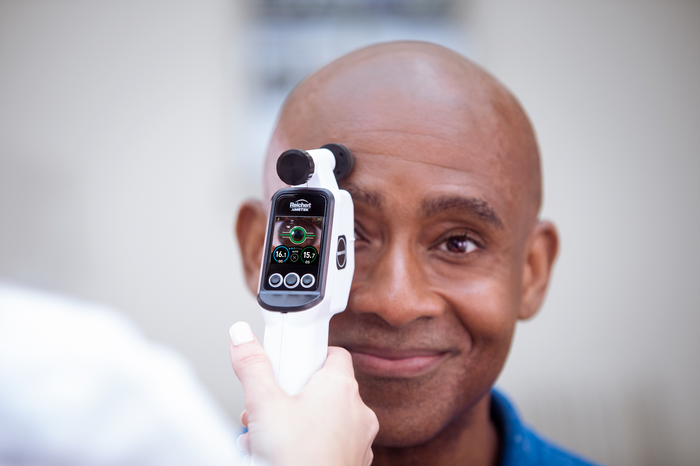 TONO-VERA HANDHELD REBOUND TONOMETER