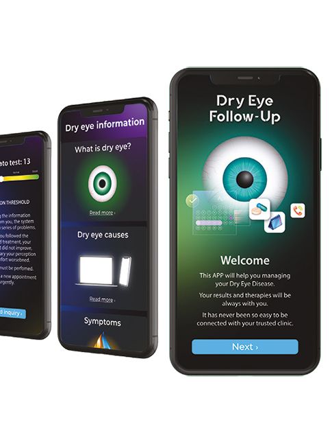 OS1000 X Automated Topographer + Dry Eye Analyser