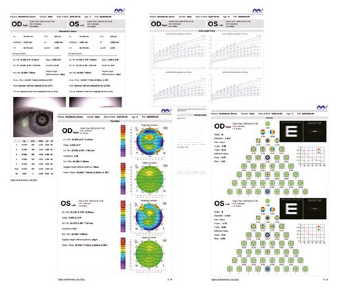 AL551 AUTOMATIC OPTICAL BIOMETER