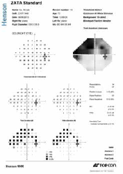 FIELD NAVIGATOR EYE TRACKING PERIMETER